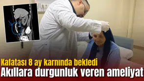Akıllara durgunluk veren ameliyat: Kafatası 8 ay karnında bekledi