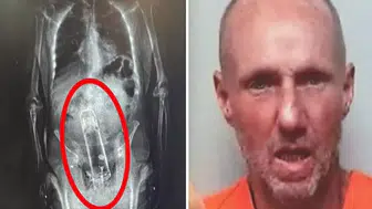 X-Ray'de fark ettiler! Adamın içinden çıkan polisleri şaşkına çevirdi