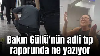 Bakın Güllü'nün adli tıp raporunda ne yazıyor