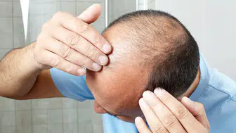 Kellik Tarih Olabilir mi? Bilim İnsanları 20 Günde Saç Çıkardı!