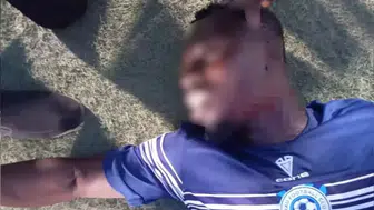 Skandal! Futbolcunun boğazını kesti