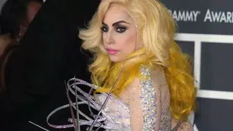 Lady Gaga'nın hastalığı bakın neymiş