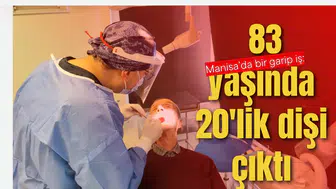 Manisa'da bir garip iş: 83 yaşında 20'lik dişi çıktı