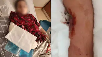 9 yaşındaki çocuk, 8 yaşındaki çocuktan böyle intikam aldı