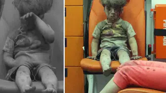 Tüm dünyanın yüreğini sızlatmıştı! Ümran bakın nerede ortaya çıktı