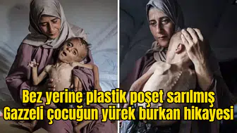 Bez yerine plastik poşet sarılmış Gazzeli çocuğun yürek burkan hikayesi