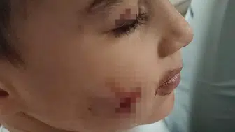 Minik çocuk lağım faresinin hışmına uğradı