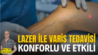 Lazer ile varis tedavisi konforlu ve etkili