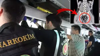 Hastanede çekilen filmdeki detay doktorları bile şaşkına çevirdi