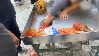 Salça yapma makinesine elini kaptırdı