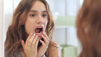 Ağızda Sürekli Çıkan Aftın Nedeni Bu Besinler Olabilir! Aft Nedir, Nasıl Geçer?