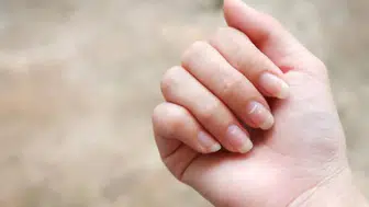 Tırnaklarınıza dikkatli bakın: Bu belirtiler altta yatan hastalıkların habercisi olabilir