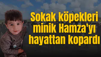 Sokak köpekleri minik Hamza'yı hayattan kopardı