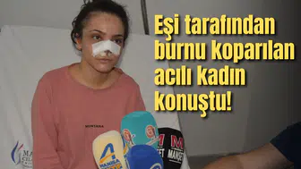 Eşi tarafından burnu koparılan acılı kadın konuştu!
