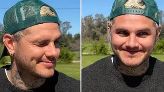 Mauro Icardi'nin son hali taraftarların ilgisini çekti