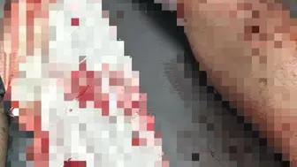 Trafik cezası yüzünden 20 yaşındaki arkadaşını bıçakladı