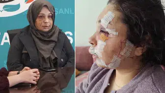 Cumhurbaşkanı Koruma Dairesi personeli bakın eşini ne hale getirdi