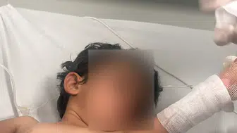 3 yaşındaki bebek ölümden döndü