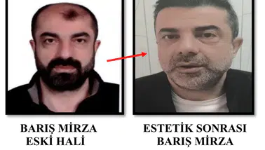 Ameliyat ile yüzünü değiştirdi yine de polisten kaçamadı