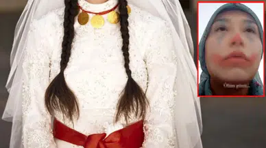 15 yaşındaki kız çocuğunun yardım çığlığı: Ailesi tarafından zorla evlendirildi