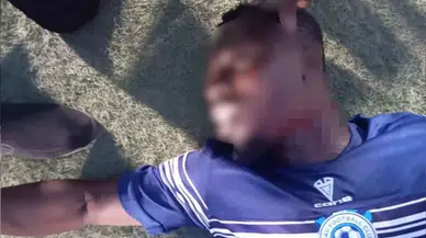 Skandal! Futbolcunun boğazını kesti