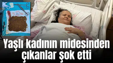 Yaşlı kadının midesinden çıkanlar şok etti
