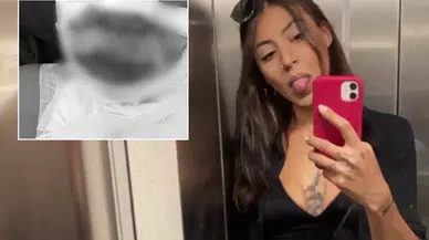 İstanbul'un lüks semtinde bir kadın yakıldı!