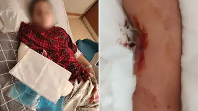 9 yaşındaki çocuk, 8 yaşındaki çocuktan böyle intikam aldı