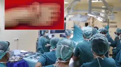Eşi benzeri olmayan olay! Kulağını 5 ay ayağında taşıdı