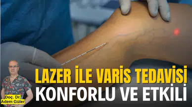 Lazer ile varis tedavisi konforlu ve etkili