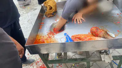 Salça yapma makinesine elini kaptırdı