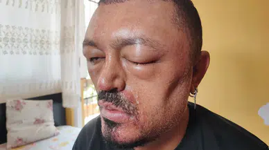 ŞAMPUANLA HAYATI KARARIYORDU!