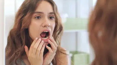 Ağızda Sürekli Çıkan Aftın Nedeni Bu Besinler Olabilir! Aft Nedir, Nasıl Geçer?