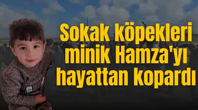 Sokak köpekleri minik Hamza'yı hayattan kopardı