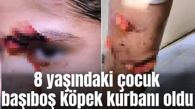 8 yaşındaki çocuk başıboş köpek kurbanı oldu