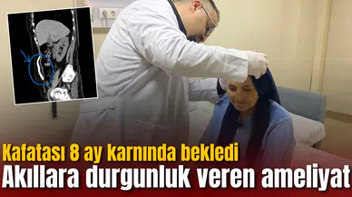 Akıllara durgunluk veren ameliyat: Kafatası 8 ay karnında bekledi