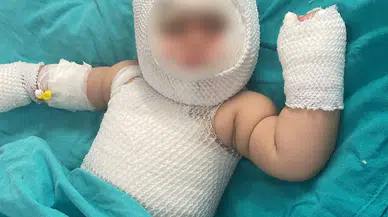 Patlayan konserve 9 aylık bebeğe dehşeti yaşattı