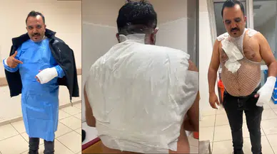 Akım yapayım derken kendini yaktı