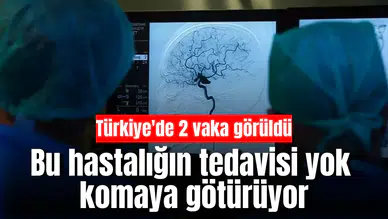 Bu hastalığın tedavisi yok, komaya götürüyor