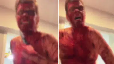 Ünlü isim TikTok canlı yayınında kendine zarar verdi!