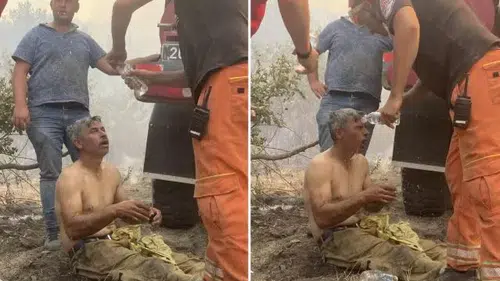 "Yanıyorum!" diyerek feryat eden orman işçisinin son hali: Eşi paylaştı