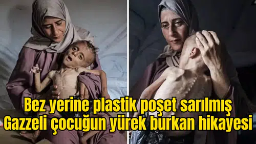 Bez yerine plastik poşet sarılmış Gazzeli çocuğun yürek burkan hikayesi