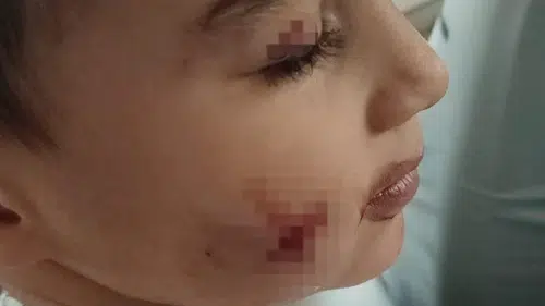 Minik çocuk lağım faresinin hışmına uğradı