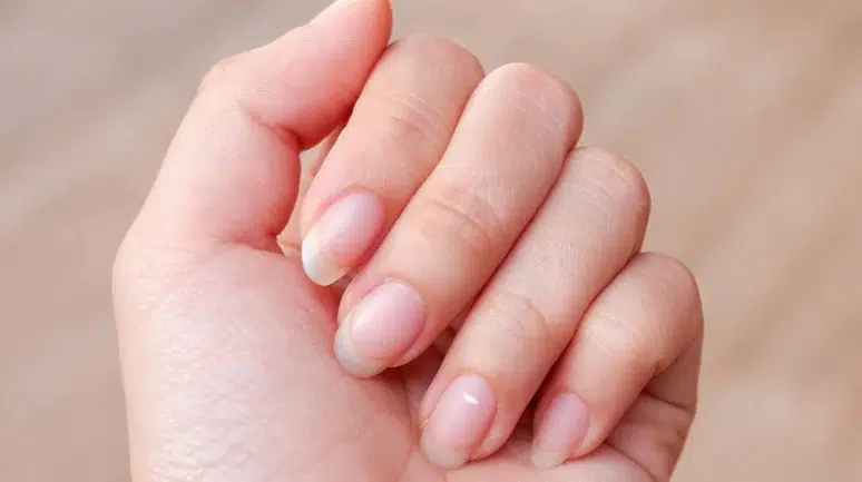 Tırnakta Beyaz Leke Neden Olur? Uzmanlar Açıkladı, Ciddiye Alınmalı!