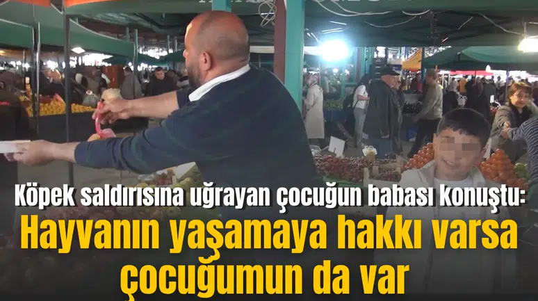 Köpek saldırısına uğrayan çocuğun babası konuştu: Hayvanın yaşamaya hakkı varsa çocuğumun da var