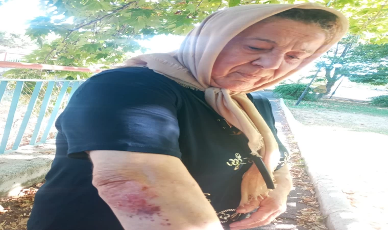 Turgutlu’da bozuk yürüyüş parkurunda düşen kadın yaralandı 