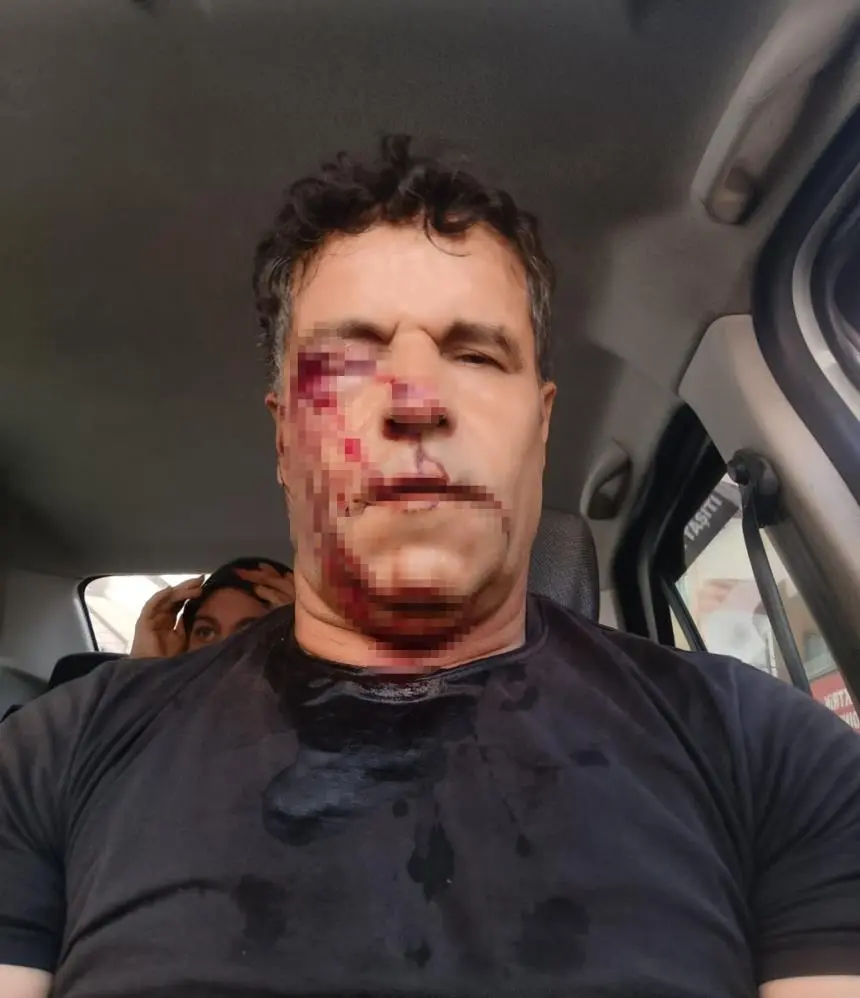 Kafası taşla ezilmek istenen baygın kocasını saldırganlara taş atarak kurtardı