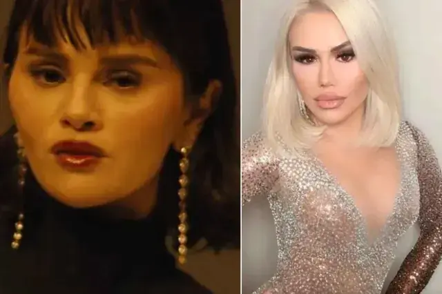 Estetiği abartan Selena Gomez'in son hali türkücü Ceylan'a benzetildi