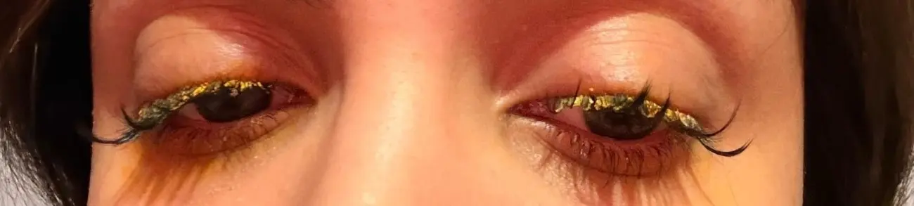 Güzellik merkezinde genç kadının gözüne yapıştırıcı kaçtı: 