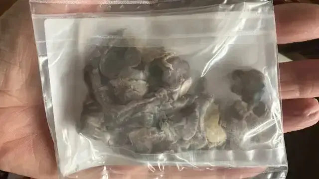 Daha 17 yaşında! Hastaneye zor yetiştirdiler, öğrendikleri gerçekle yıkıldılar